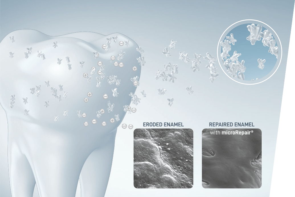 microrepair
